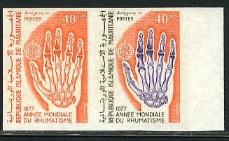 Mauritania_1977_Yvert_371-Scott_366_pair_a