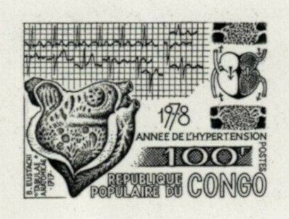 Congo_1978_Yvert_532-Scott_487_black_c_detail